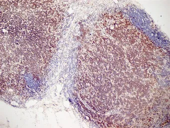 Anti-CD3 antibody [KT3] used in IHC (Frozen sections) (IHC-Fr). GTX42106