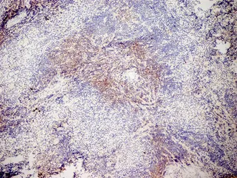 Anti-CD3 antibody [KT3] (Low endotoxin, azide free) used in IHC (Frozen sections) (IHC-Fr). GTX42108