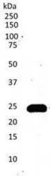 Anti-CD3 epsilon antibody [CD3-12] used in Western Blot (WB). GTX42110