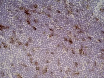 Anti-IL2 Receptor alpha antibody [OX-39] used in IHC (Frozen sections) (IHC-Fr). GTX42210