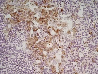 Anti-Mannose Receptor antibody [MR5D3] used in IHC (Frozen sections) (IHC-Fr). GTX42265