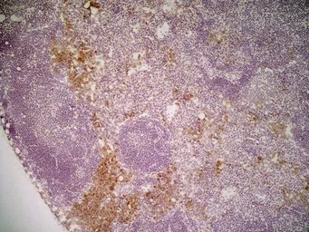 Anti-Mannose Receptor antibody [MR5D3] used in IHC (Frozen sections) (IHC-Fr). GTX42265