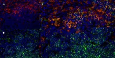 Anti-CD169 antibody [ED3] used in IHC (Frozen sections) (IHC-Fr). GTX42356