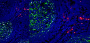 Anti-CD163 antibody [EDHu-1] used in IHC (Frozen sections) (IHC-Fr). GTX42364