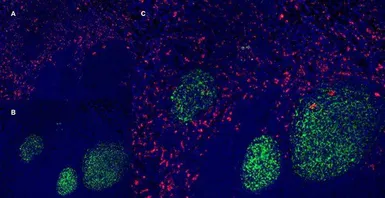 Anti-CD163 antibody [EDHu-1] used in IHC (Frozen sections) (IHC-Fr). GTX42365