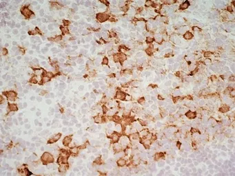 Anti-CD163 antibody [ED2] used in IHC (Frozen sections) (IHC-Fr). GTX42366