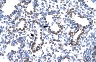 Anti-HEY1 antibody, C-term used in IHC (Paraffin sections) (IHC-P). GTX42614