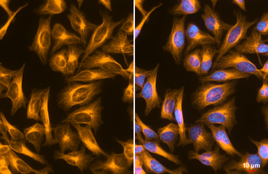 FSD Fluor&trade; Triple-Color (488/594/647) Antibody Labeling Kit. GTX440440