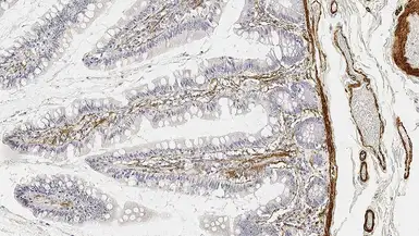 Anti-alpha Smooth Muscle Actin antibody [αsm-1] used in IHC (Paraffin sections) (IHC-P). GTX44499
