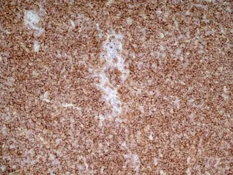 Anti-CD4 antibody [OX-35] used in IHC (Frozen sections) (IHC-Fr). GTX44519