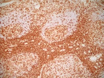 Anti-CD4 antibody [RPA-T4] (Low endotoxin, azide free) used in IHC (Frozen sections) (IHC-Fr). GTX44537