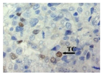 Anti-ID1 antibody [195-14] used in Immunohistochemistry (IHC). GTX44599