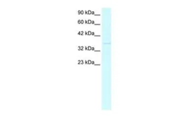 Anti-CDX4 antibody, C-term used in Western Blot (WB). GTX44611