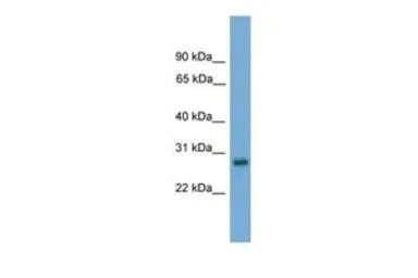 Anti-ABT1 antibody, Internal used in Western Blot (WB). GTX44651