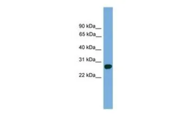 Anti-ABT1 antibody, C-term used in Western Blot (WB). GTX44652