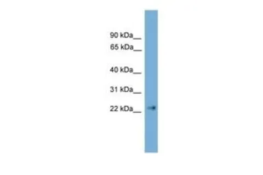 Anti-Claudin 6 antibody, C-term used in Western Blot (WB). GTX44676