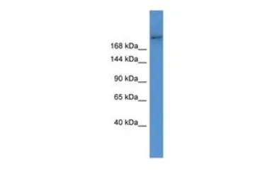 Anti-ABCA7 antibody, Internal used in Western Blot (WB). GTX44680
