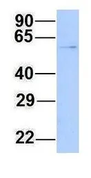 Anti-CHAF1B antibody, N-term used in Western Blot (WB). GTX44690
