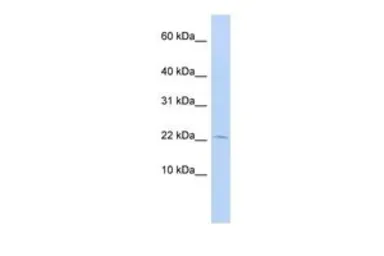 Anti-FKBP2 antibody, N-term used in Western Blot (WB). GTX44851