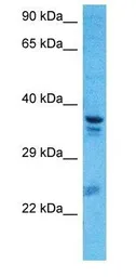 Anti-A2BP1 antibody, N-term used in Western Blot (WB). GTX44870