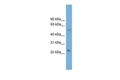 Anti-BBS4 antibody, N-term used in Western Blot (WB). GTX44878