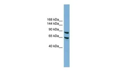Anti-EXOC6 antibody, N-term used in Western Blot (WB). GTX44929