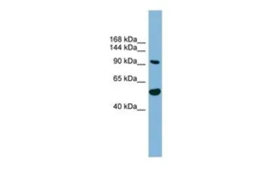Anti-MAP7D1 antibody, N-term used in Western Blot (WB). GTX44977