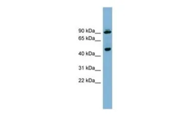Anti-WIPI1 antibody, Internal used in Western Blot (WB). GTX44982