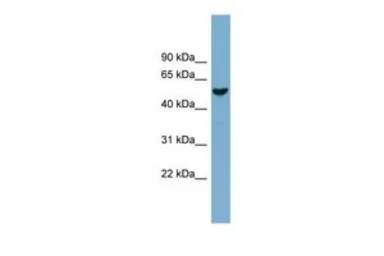 Anti-FAM83E antibody, Internal used in Western Blot (WB). GTX44988