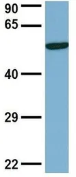 Anti-DCTN4 antibody, N-term used in Western Blot (WB). GTX45016