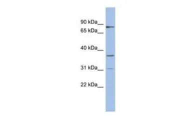 Anti-OLAH antibody, N-term used in Western Blot (WB). GTX45080