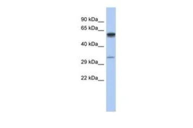 Anti-ZDHHC24 antibody, Internal used in Western Blot (WB). GTX45140