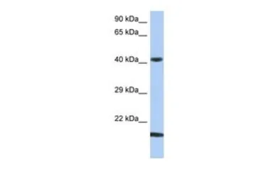Anti-SEC14L4 antibody, N-term used in Western Blot (WB). GTX45212