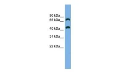 Anti-GSPT2 antibody, Internal used in Western Blot (WB). GTX45292