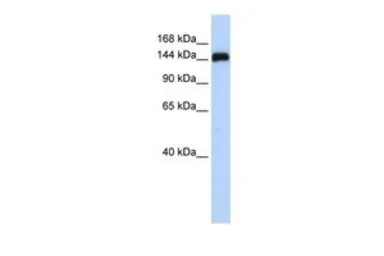 Anti-KIAA0182 antibody, N-term used in Western Blot (WB). GTX45337