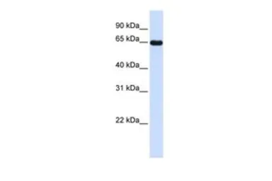 Anti-LMOD1 antibody, N-term used in Western Blot (WB). GTX45370