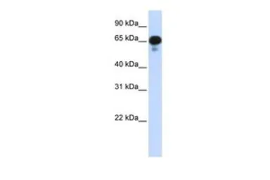 Anti-PPM1J antibody, N-term used in Western Blot (WB). GTX45386