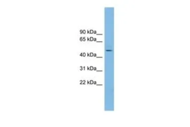 Anti-NKAPL antibody, Internal used in Western Blot (WB). GTX45432