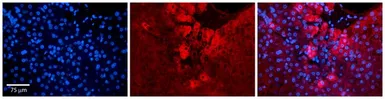 Anti-ZC3H14 antibody, N-term used in IHC (Paraffin sections) (IHC-P). GTX45443