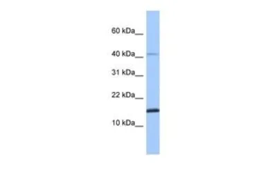 Anti-SPAG11B antibody, N-term used in Western Blot (WB). GTX45472