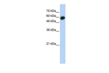 Anti-LRRC6 antibody, Internal used in Western Blot (WB). GTX45478