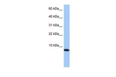 Anti-TNP1 antibody, N-term used in Western Blot (WB). GTX45488