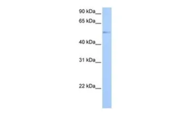 Anti-GRK4 antibody, Internal used in Western Blot (WB). GTX45498