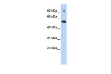 Anti-LRRC50 antibody, N-term used in Western Blot (WB). GTX45546