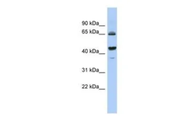 Anti-2'-PDE antibody, Internal used in Western Blot (WB). GTX45550