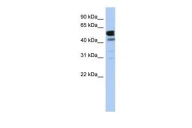 Anti-LDHD antibody, Internal used in Western Blot (WB). GTX45601
