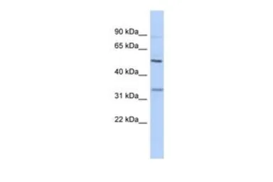 Anti-PRSS35 antibody, N-term used in Western Blot (WB). GTX45602