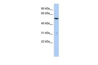 Anti-TMEM161B antibody, N-term used in Western Blot (WB). GTX45605