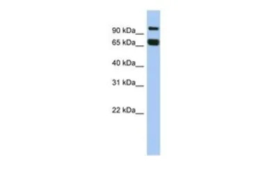 Anti-GGN antibody, N-term used in Western Blot (WB). GTX45630