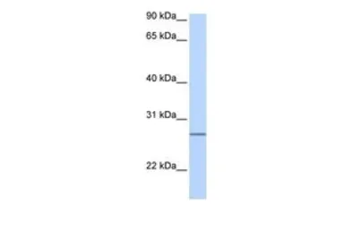 Anti-GRPEL2 antibody, Internal used in Western Blot (WB). GTX45661